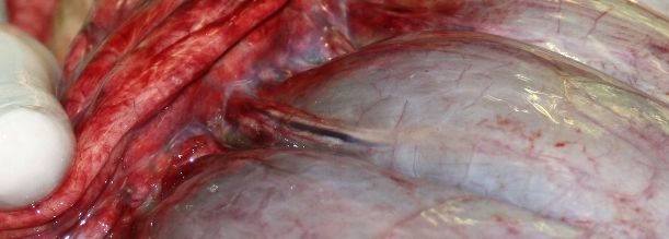 Ansicht eines Darmabschnitts bei einer Kolik OP