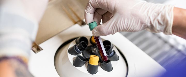 Herstellung von plättchenreichem Plasma in einer Zentrifuge